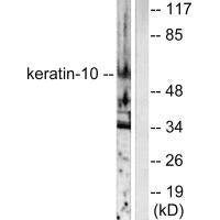 Western blot analysis of extracts from HeLa cells, using Keratin 10 antibody.