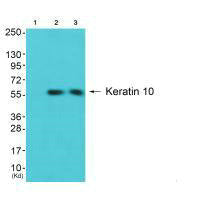 Western blot analysis of extracts from COS7 cells and 3T3 cells using Keratin 10 antibody. The lane on the left is treated with synthesized peptide.