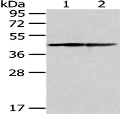 Gel: 8%SDS-PAGE, Lysate: 40 μg, Lane 1-2: A431 and hela cell, Primary antibody: ERP44 Antibody(ERP44 Antibody) at dilution 1/450 dilution, Secondary antibody: Goat anti rabbit IgG at 1/8000 dilution, Exposure time: 2 minutes