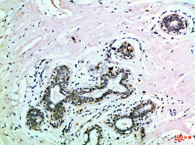 Immunohistochemical analysis of paraffin-embedded Human-breast, antibody was diluted at 1:100Rabbit anti-Human EPHB3 Polyclonal Antibody