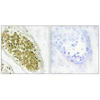 Immunohistochemistry analysis of paraffin-embedded human testis tissue using HIPK4 antibody.Rabbit anti-Human HIPK4 Polyclonal Antibody