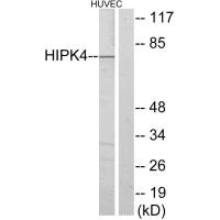 Western blot analysis of extracts from HUVEC cells, using HIPK4 antibody.Rabbit anti-Human HIPK4 Polyclonal Antibody