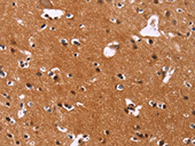 The image on the left is immunohistochemistry of paraffin-embedded Human brain  tissue using CBX3 Antibody(CBX3 Antibody) at dilution 1/40, on the right is treated with synthetic peptide. (Original magnification: ×200)