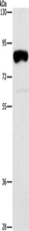 Gel: 8%SDS-PAGE, Lysate: 40 μg, Lane: Hela cells, Primary antibody: ARHGAP25 Antibody(ARHGAP25 Antibody) at dilution 1/250, Secondary antibody: Goat anti rabbit IgG at 1/8000 dilution, Exposure time: 30 secondsRabbit anti-Human ARHGAP25 Polyclonal Antibody