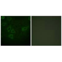 Immunofluorescence analysis of HepG2 cells, using TK (Ab-13) antibody.Rabbit anti-Human TK1 Polyclonal Antibody