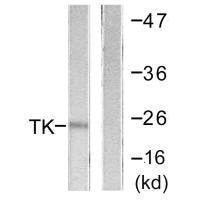 Western blot analysis of extracts from COLO205 cells, using TK (Ab-13) antibody.Rabbit anti-Human TK1 Polyclonal Antibody