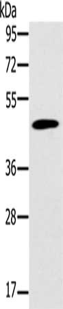 Gel: 8%SDS-PAGE, Lysate: 40 μg, Lane: Mouse pancreas tissue, Primary antibody: KCNJ15 Antibody(KCNJ15 Antibody) at dilution 1/200, Secondary antibody: Goat anti rabbit IgG at 1/8000 dilution, Exposure time: 30 seconds