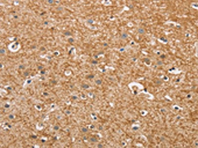 The image on the left is immunohistochemistry of paraffin-embedded Human brain  tissue using CYP4A11 Antibody(CYP4A11 Antibody) at dilution 1/30, on the right is treated with fusion protein. (Original magnification: ×200)Rabbit anti-Human CYP4A11 Polyclonal Antibody