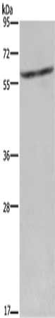 Gel: 8%SDS-PAGE, Lysate: 40 μg, Lane: Mouse liver tissue, Primary antibody: CYP4A11 Antibody(CYP4A11 Antibody) at dilution 1/250, Secondary antibody: Goat anti rabbit IgG at 1/8000 dilution, Exposure time: 2 minutesRabbit anti-Human CYP4A11 Polyclonal Antibody