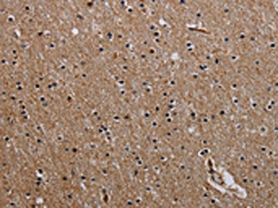 The image on the left is immunohistochemistry of paraffin-embedded Human brain  tissue using PCDHAC1 Antibody(PCDHAC1 Antibody) at dilution 1/30, on the right is treated with synthetic peptide. (Original magnification: ×200)Rabbit anti-Human PCDHAC1 Polyclonal Antibody