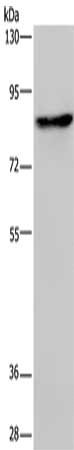 Gel: 6%SDS-PAGE, Lysate: 40 μg, Lane: A549 cells, Primary antibody: PCDHAC1 Antibody(PCDHAC1 Antibody) at dilution 1/200, Secondary antibody: Goat anti rabbit IgG at 1/8000 dilution, Exposure time: 1 minuteRabbit anti-Human PCDHAC1 Polyclonal Antibody