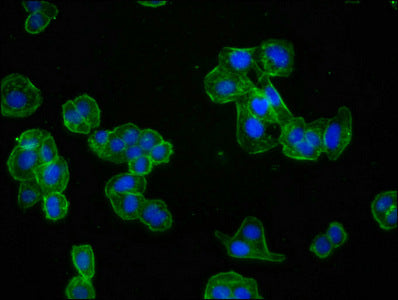 Immunofluorescence staining of HepG2 cells with ACTA1 Recombinant Monoclonal Antibody at 1:60,counter-stained with DAPI. The cells were fixed in 4% formaldehyde, permeabilized using 0.2% Triton X-100 and blocked in 10% normal Goat Serum. The cells were then incubated with the antibody overnight at 4℃.The secondary antibody was Alexa Fluor 488-congugated AffiniPure Goat Anti-Rabbit IgG (H+L).ACTA1 Recombinant Monoclonal Antibody