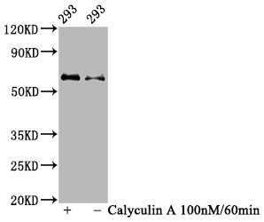 Western Blot | Positive WB detected in 293 whole cell lysate(treated with Calyculin A or not) | All lanes Phospho-AKT1 antibody at 1.08μg/ml | Secondary | Goat polyclonal to rabbit IgG at 1/50000 dilution | Predicted band size: 60 KDa | Observed band size: 60 KDaPhospho-AKT1 (Ser473) Recombinant Monoclonal Antibody