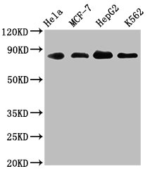 Western Blot | Positive WB detected in: Hela whole cell lysate, MCF-7 whole cell lysate, HepG2 whole cell lysate, K562 whole cell lysate | All lanes: ARNT antibody at 1.83μg/ml | Secondary | Goat polyclonal to rabbit IgG at 1/50000 dilution | Predicted band size: 87, 85, 86 KDa | Observed band size: 87 KDaARNT Recombinant Monoclonal Antibody