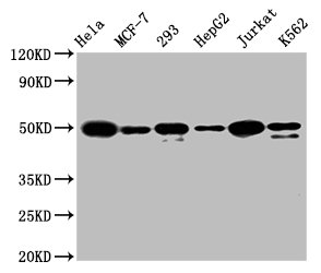 Western Blot | Positive WB detected in: Hela whole cell lysate, MCF-7 whole cell lysate, 293 whole cell lysate, HepG2 whole cell lysate, Jurkat whole cell lysate, K562 whole cell lysate | All lanes: ATF4 antibody at 1.6μg/ml | Secondary | Goat polyclonal to rabbit IgG at 1/50000 dilution | Predicted band size: 39 KDa | Observed band size: 50 KDaATF4 Recombinant Monoclonal Antibody