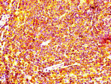 IHC image of BCL2 Recombinant Monoclonal Antibody diluted at 1:100 and staining in paraffin-embedded human lymph node tissue performed on a Leica BondTM system. After dewaxing and hydration, antigen retrieval was mediated by high pressure in a citrate buffer (pH 6.0). Section was blocked with 10% normal goat serum 30min at RT. Then primary antibody (1% BSA) was incubated at 4°C overnight. The primary is detected by a biotinylated secondary antibody and visualized using an HRP conjugated SP system.BCL2 Recombinant Monoclonal Antibody