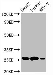 Western Blot | Positive WB detected in:HepG2 whole cell lysate,Jurkat whole cell lysate,MCF-7 whole cell lysate | All lanes:BCL2 antibody at 1μg/ml | Secondary | Goat polyclonal to rabbit IgG at 1/50000 dilution | Predicted band size: 26 KDa | Observed band size: 26 KDaBCL2 Recombinant Monoclonal Antibody