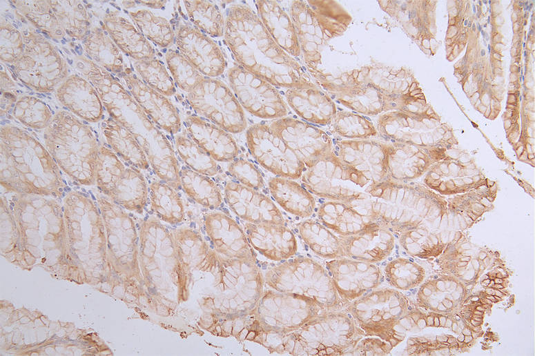 IHC image of CASP3 Recombinant Monoclonal Antibody diluted at 1:100 and staining in paraffin-embedded human stomach tissue performed on a Leica BondTM system. After dewaxing and hydration, antigen retrieval was mediated by high pressure in a citrate buffer (pH 6.0). Section was blocked with 10% normal goat serum 30min at RT. Then primary antibody (1% BSA) was incubated at 4°C overnight. The primary is detected by a Goat anti-rabbit polymer IgG labeled by HRP and visualized using 0.18% DAB.