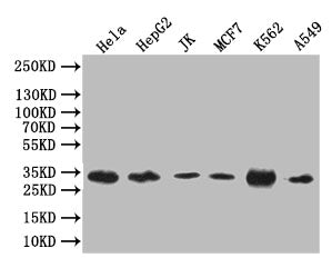 Western Blot | Positive WB detected in: Hela whole cell lysate, HepG2 whole cell lysate, JK whole cell lysate, MCF7 whole cell lysate, K562 whole cell lysate, A549 whole cell lysate | All lanes: Caspase 3 antibody at 1:1000 | Secondary | Goat polyclonal to rabbit IgG at 1/50000 dilution | Predicted band size: 32 kDa | Observed band size: 32 kDa