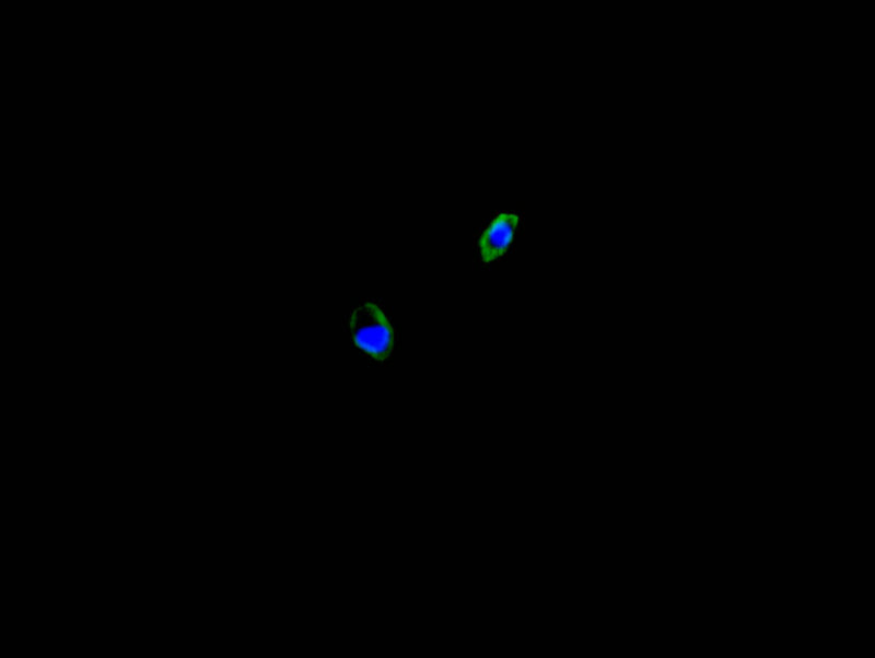 Immunofluorescence staining of HepG2 cell with CALR Recombinant Monoclonal Antibody at 1:250, counter-stained with DAPI. The cells were fixed in 4% formaldehyde and blocked in 10% normal Goat Serum. The cells were then incubated with the antibody overnight at 4C. The secondary antibody was FITC-conjugated AffiniPure Goat Anti-Mouse IgG(H+L).