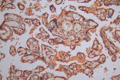 IHC image of CALR Recombinant Monoclonal Antibody diluted at 1:300 and staining in paraffin-embedded human placenta tissue performed on a Leica BondTM system. After dewaxing and hydration, antigen retrieval was mediated by high pressure in a citrate buffer (pH 6.0). Section was blocked with 10% normal goat serum 30min at RT. Then primary antibody (1% BSA) was incubated at 4°C overnight. The primary is detected by a Goat anti-Mouse IgG labeled by HRP and visualized using 0.05% DAB.