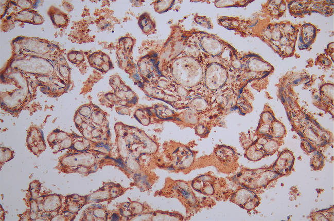 IHC image of CALR Recombinant Monoclonal Antibody diluted at 1:300 and staining in paraffin-embedded human placenta tissue performed on a Leica BondTM system. After dewaxing and hydration, antigen retrieval was mediated by high pressure in a citrate buffer (pH 6.0). Section was blocked with 10% normal goat serum 30min at RT. Then primary antibody (1% BSA) was incubated at 4°C overnight. The primary is detected by a Goat anti-Mouse IgG labeled by HRP and visualized using 0.05% DAB.