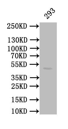 Western Blot | Positive WB detected in: 293 whole cell lysate | All lanes: CALR antibody at 1:1000 | Secondary | Goat polyclonal to mouse IgG at 1/50000 dilution | Predicted band size: 49 kDa | Observed band size: 49 kDa