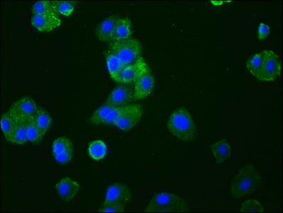 Immunofluorescence staining of HepG2 cells with CCR9 Recombinant Monoclonal Antibody at 1:33, counter-stained with DAPI. The cells were fixed in 4% formaldehyde, permeabilized using 0.2% Triton X-100 and blocked in 10% normal Goat Serum. The cells were then incubated with the antibody overnight at 4℃. The secondary antibody was Alexa Fluor 488-congugated AffiniPure Goat Anti-Rabbit IgG (H+L).