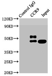 Immunoprecipitating CCR9 in HL-60 whole cell lysate | Lane 1: Rabbit control IgG instead of CCR9 Recombinant Monoclonal Antibody in HL-60 whole cell lysate. | For western blotting,a HRP-conjugated Protein G antibody was used as the secondary antibody (1/2000) | Lane 2: CCR9 Recombinant Monoclonal Antibody (3μg) + HL-60 whole cell lysate (500μg) | Lane 3: HL-60 whole cell lysate (20μg)