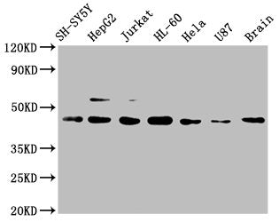 Western Blot | Positive WB detected in: SH-SY5Y whole cell lysate, HepG2 whole cell lysate, Jurkat whole cell lysate, HL-60 whole cell lysate, Hela whole cell lysate, U87 whole cell lysate, Mouse brain tissue | All lanes: CCR9 antibody at 1μg/ml | Secondary | Goat polyclonal to rabbit IgG at 1/50000 dilution | Predicted band size: 43, 41 KDa | Observed band size: 43 KDa