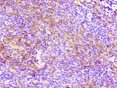 IHC image of CD4 Recombinant Monoclonal Antibody diluted at 1:100 and staining in paraffin-embedded human lymph node tissue performed on a Leica BondTM system. After dewaxing and hydration, antigen retrieval was mediated by high pressure in a citrate buffer (pH 6.0). Section was blocked with 10% normal goat serum 30min at RT. Then primary antibody (1% BSA) was incubated at 4℃ overnight. The primary is detected by a biotinylated secondary antibody and visualized using an HRP conjugated SP system.