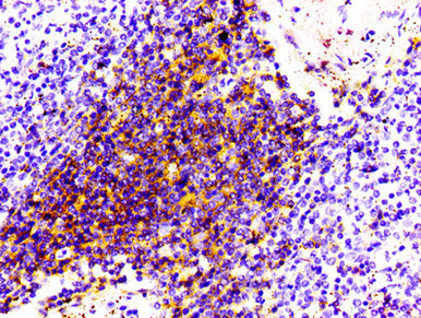 IHC image of CD4 Recombinant Monoclonal Antibody diluted at 1:100 and staining in paraffin-embedded human spleen tissue performed on a Leica BondTM system. After dewaxing and hydration, antigen retrieval was mediated by high pressure in a citrate buffer (pH 6.0). Section was blocked with 10% normal goat serum 30min at RT. Then primary antibody (1% BSA) was incubated at 4℃ overnight. The primary is detected by a biotinylated secondary antibody and visualized using an HRP conjugated SP system.