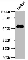 Western Blot | Positive WB detected in Jurkat whole cell lysate | All lanes CD4 antibody at 0.8μg/ml | Secondary | Goat polyclonal to rabbit IgG at 1/50000 dilution | Predicted band size: 55 KDa | Observed band size: 55 KDa