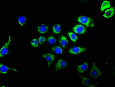 Immunofluorescence staining of A549 cells with CD63 Recombinant Monoclonal Antibody at 1:51, counter-stained with DAPI. The cells were fixed in 4% formaldehyde, permeabilized using 0.2% Triton X-100 and blocked in 10% normal Goat Serum. The cells were then incubated with the antibody overnight at 4℃. The secondary antibody was Alexa Fluor 488-congugated AffiniPure Goat Anti-Rabbit IgG (H+L).