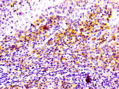 IHC image of CD81 Recombinant Monoclonal Antibody diluted at 1:100 and staining in paraffin-embedded human tonsil tissue performed on a Leica BondTM system. After dewaxing and hydration, antigen retrieval was mediated by high pressure in a citrate buffer (pH 6.0). Section was blocked with 10% normal goat serum 30min at RT. Then primary antibody (1% BSA) was incubated at 4°C overnight. The primary is detected by a biotinylated secondary antibody and visualized using an HRP conjugated SP system.