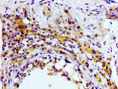 IHC image of CD81 Recombinant Monoclonal Antibody diluted at 1:100 and staining in paraffin-embedded human testis tissue performed on a Leica BondTM system. After dewaxing and hydration, antigen retrieval was mediated by high pressure in a citrate buffer (pH 6.0). Section was blocked with 10% normal goat serum 30min at RT. Then primary antibody (1% BSA) was incubated at 4°C overnight. The primary is detected by a biotinylated secondary antibody and visualized using an HRP conjugated SP system.