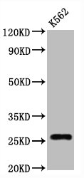 Western Blot | Positive WB detected in:K562 whole cell lysate | All lanes:CD81 antibody at 1.25μg/ml | Secondary | Goat polyclonal to rabbit IgG at 1/50000 dilution | Predicted band size: 26 KDa | Observed band size: 26 KDa
