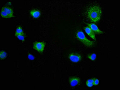 Immunofluorescence staining of MCF-7 cells with CD9 Recombinant Monoclonal Antibody at 1:34,counter-stained with DAPI. The cells were fixed in 4% formaldehyde, permeabilized using 0.2% Triton X-100 and blocked in 10% normal Goat Serum. The cells were then incubated with the antibody overnight at 4℃.The secondary antibody was Alexa Fluor 488-congugated AffiniPure Goat Anti-Rabbit IgG (H+L).