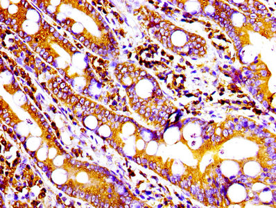 IHC image of CD9 Recombinant Monoclonal Antibody diluted at 1:100 and staining in paraffin-embedded human small intestine tissue performed on a Leica BondTM system. After dewaxing and hydration, antigen retrieval was mediated by high pressure in a citrate buffer (pH 6.0). Section was blocked with 10% normal goat serum 30min at RT. Then primary antibody (1% BSA) was incubated at 4℃ overnight. The primary is detected by a biotinylated secondary antibody and visualized using an HRP conjugated SP system.
