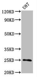 Western Blot | Positive WB detected in U87 whole cell lysate | All lanes CD9 antibody at 0.55μg/ml | Secondary | Goat polyclonal to rabbit IgG at 1/50000 dilution | Predicted band size: 25 KDa | Observed band size: 25 KDa