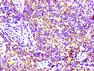 IHC image of the antibody diluted at 1:100 and staining in paraffin-embedded human lymph node tissue performed on a Leica BondTM system. After dewaxing and hydration, antigen retrieval was mediated by high pressure in a citrate buffer (pH 6.0). Section was blocked with 10% normal goat serum 30min at RT. Then primary antibody (1% BSA) was incubated at 4℃ overnight. The primary is detected by a biotinylated secondary antibody and visualized using an HRP conjugated SP system.