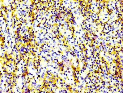 IHC image of CD97 Recombinant Monoclonal Antibody diluted at 1:100 and staining in paraffin-embedded human spleen tissue performed on a Leica BondTM system. After dewaxing and hydration, antigen retrieval was mediated by high pressure in a citrate buffer (pH 6.0). Section was blocked with 10% normal goat serum 30min at RT. Then primary antibody (1% BSA) was incubated at 4℃ overnight. The primary is detected by a biotinylated secondary antibody and visualized using an HRP conjugated SP system.