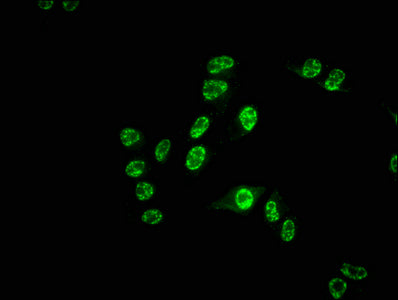 Immunofluorescence staining of Hela cells with CDC25C Recombinant Monoclonal Antibody at 1:55, counter-stained with DAPI. The cells were fixed in 4% formaldehyde, permeabilized using 0.2% Triton X-100 and blocked in 10% normal Goat Serum. The cells were then incubated with the antibody overnight at 4℃. The secondary antibody was Alexa Fluor 488-congugated AffiniPure Goat Anti-Rabbit IgG (H+L).