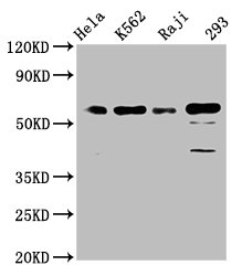 Western Blot | Positive WB detected in: Hela whole cell lysate, K562 whole cell lysate, Raji whole cell lysate, 293 whole cell lysate | All lanes: Cdc25C antibody at 1.65μg/ml | Secondary | Goat polyclonal to rabbit IgG at 1/50000 dilution | Predicted band size: 54, 52, 49, 46 KDa | Observed band size: 60 KDa