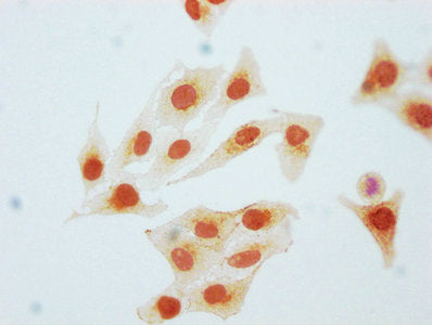 Immunocytochemistry analysis of Phospho-CDK2 (Y15) Recombinant Monoclonal Antibody diluted at 1:80 and staining in Hela cells(treated with Pervanadate) performed on a Leica BondTM system. The cells were fixed in 4% formaldehyde, permeabilized using 0.2% Triton X-100 and blocked with 10% normal goat serum 30min at RT. Then primary antibody (1% BSA) was incubated at 4℃ overnight. The primary is detected by a biotinylated secondary antibody and visualized using an HRP conjugated SP system.Phospho-CDK2 (Y15) Recombinant Monoclonal Antibody