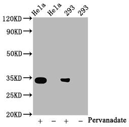 Western BlotPositive WB detected in:Hela whole cell lysate, 293 whole cell lysate(treated with Pervanadate or not)All lanes:Phospho-CDK2 antibody at 0.8μg/mlSecondaryGoat polyclonal to rabbit IgG at 1/50000 dilutionPredicted band size: 34 KDaObserved band size: 34 KDaPhospho-CDK2 (Y15) Recombinant Monoclonal Antibody