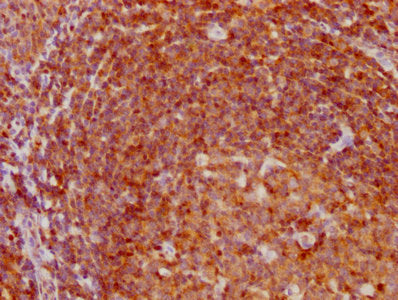 IHC image of CDKN1B Recombinant Monoclonal Antibody diluted at 1:97.5 and staining in paraffin-embedded human tonsil tissue performed on a Leica BondTM system. After dewaxing and hydration, antigen retrieval was mediated by high pressure in a citrate buffer (pH 6.0). Section was blocked with 10% normal goat serum 30min at RT. Then primary antibody (1% BSA) was incubated at 4℃ overnight. The primary is detected by a biotinylated secondary antibody and visualized using an HRP conjugated SP system.
