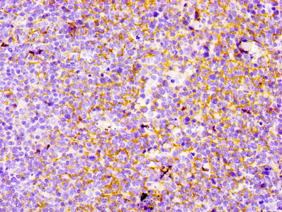 IHC image of CY5710 diluted at 1:100 and staining in paraffin-embedded human tonsil tissue performed on a Leica BondTM system. After dewaxing and hydration, antigen retrieval was mediated by high pressure in a citrate buffer (pH 6.0). Section was blocked with 10% normal goat serum 30min at RT. Then primary antibody (1% BSA) was incubated at 4℃ overnight. The primary is detected by a biotinylated secondary antibody and visualized using an HRP conjugated SP system.