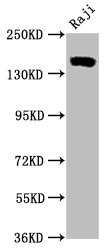 Western Blot | Positive WB detected in Raji whole cell lysate | All lanes CD21 antibody at 0.55μg/ml | Secondary | Goat polyclonal to rabbit IgG at 1/50000 dilution | Predicted band size: 155 KDa | Observed band size: 155 KDa