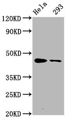 Western Blot | Positive WB detected in Hela whole cell lysate,293 whole cell lysate | All lanes Phospho-CREB1 antibody at 1.65μg/ml | Secondary | Goat polyclonal to rabbit IgG at 1/50000 dilution | Predicted band size: 46 KDa | Observed band size: 46 KDaPhospho-CREB1 (S133) Recombinant Monoclonal Antibody